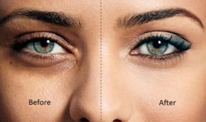 Removing badly can be the cause of your dark circles!